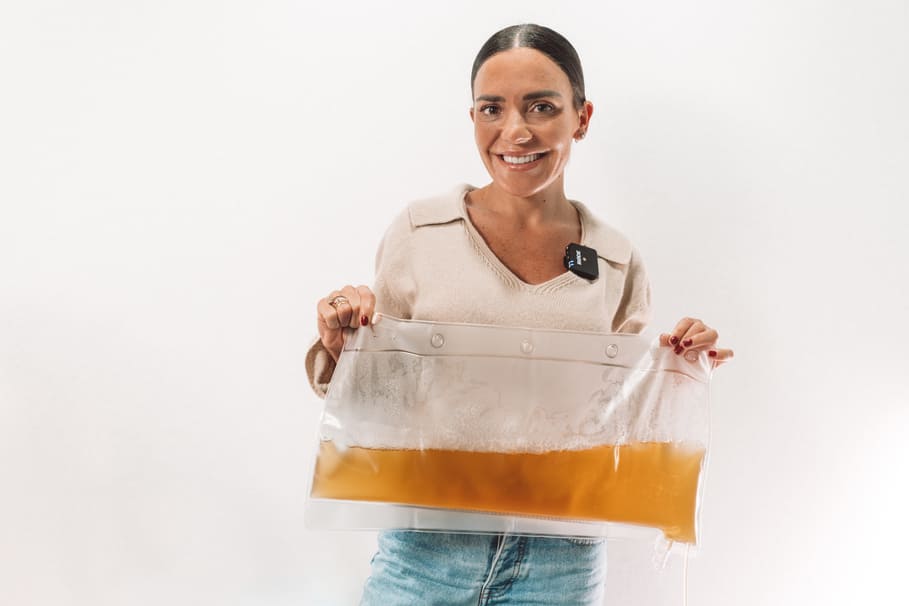 Tratamiento plasmaféresis