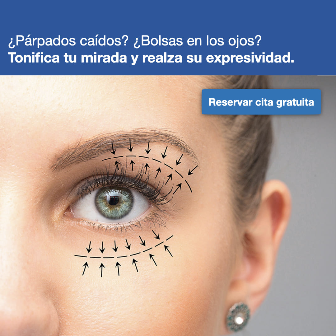 Blefaroplastia