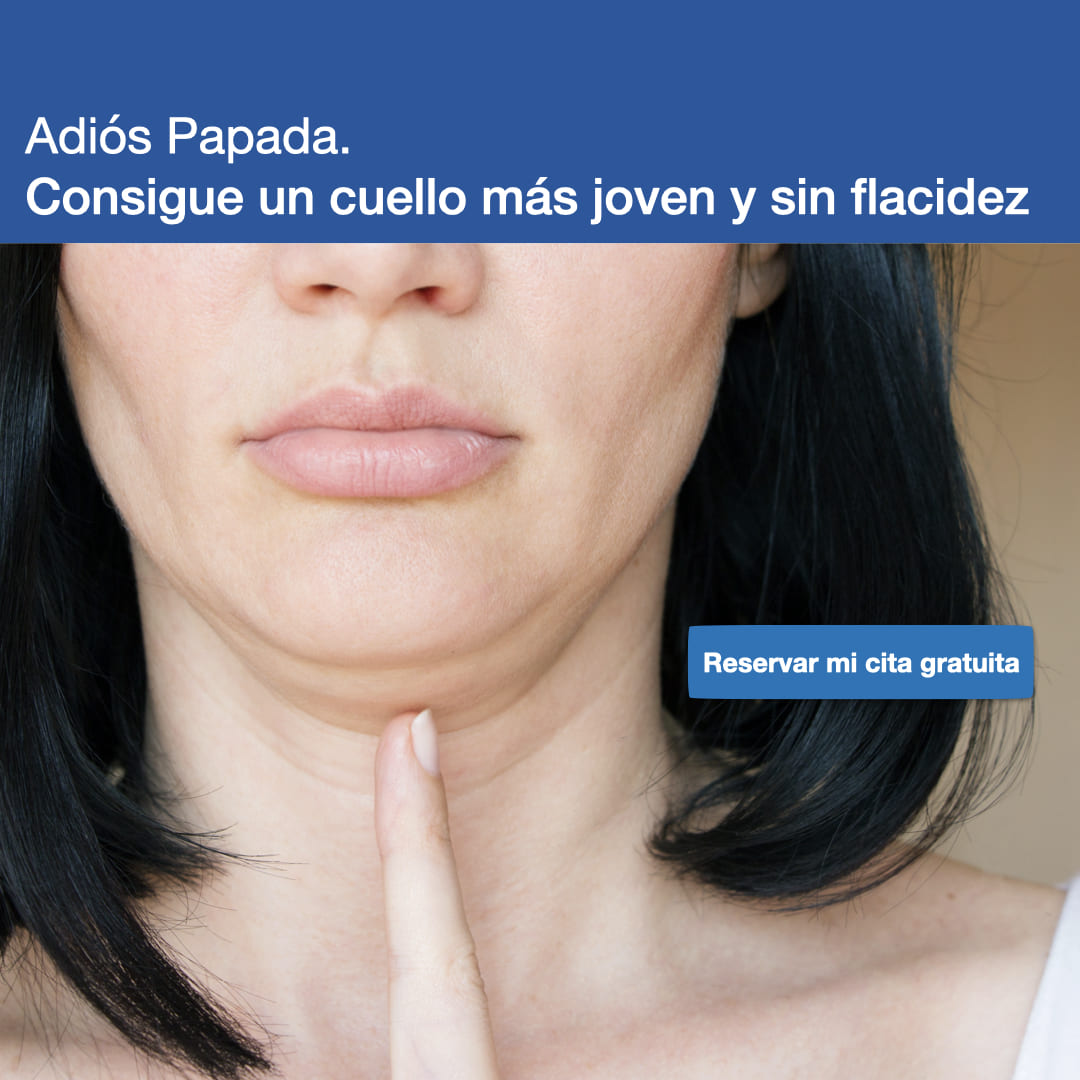 Eliminación de Papada