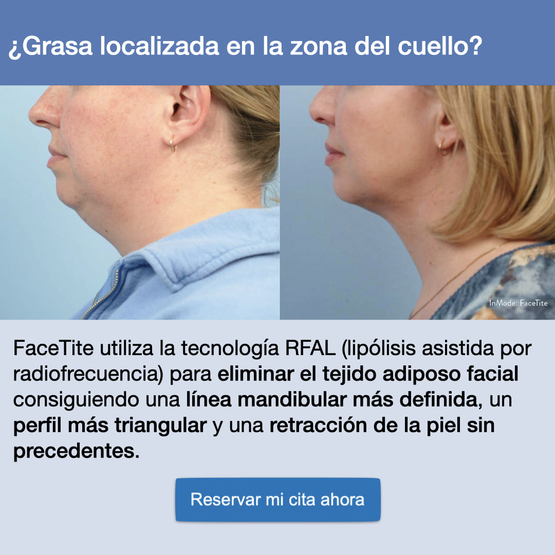 Eliminación de Papada