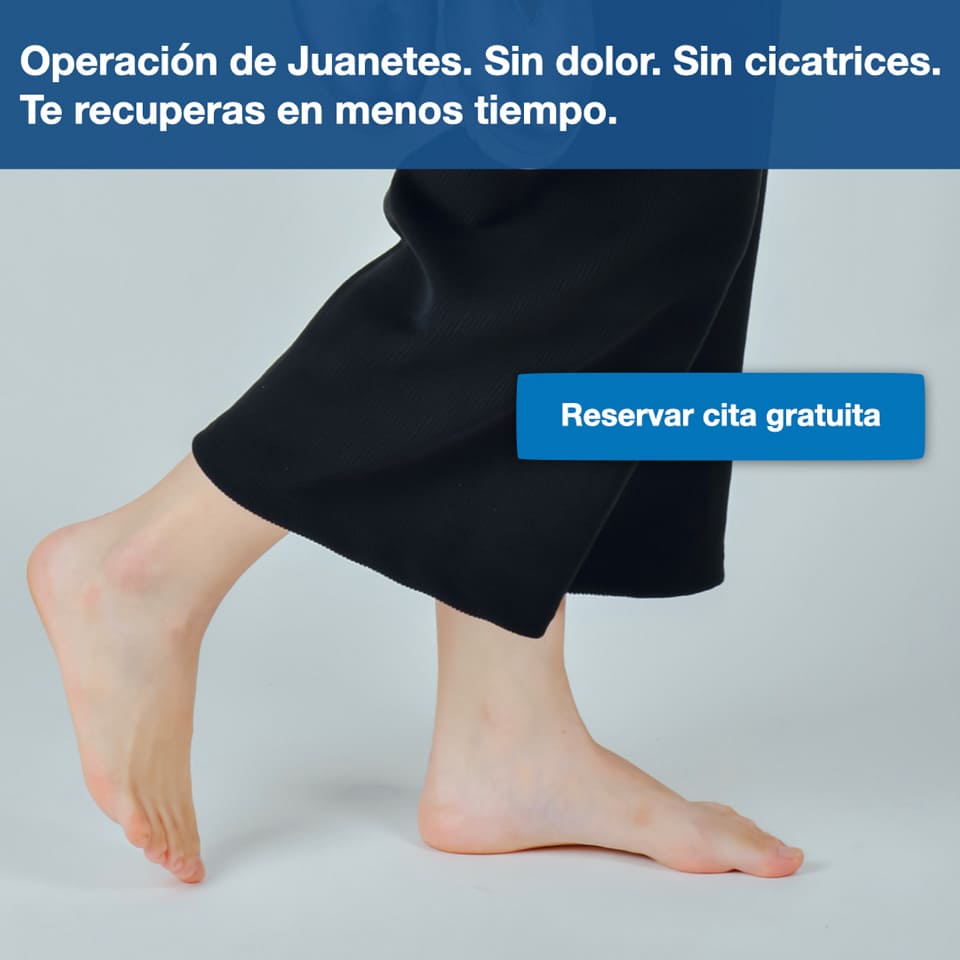 Operación de Juanetes