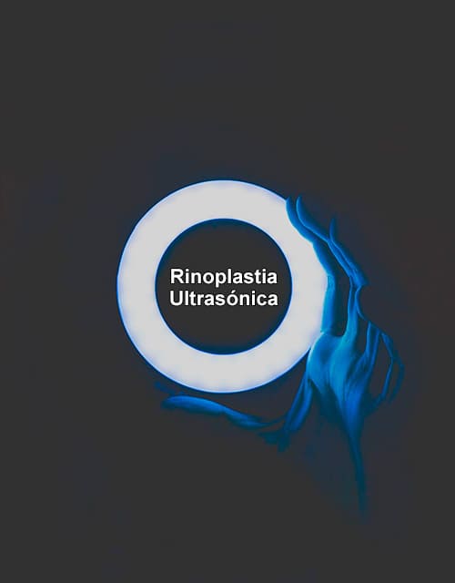 Rinoplastia Ultrasónica