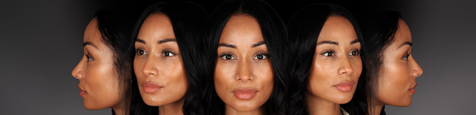 Rinoplastia Ultrasónica